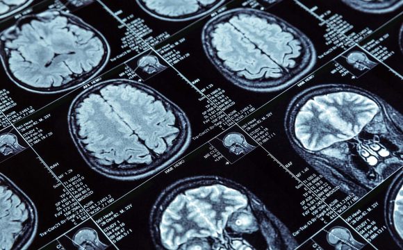 brain